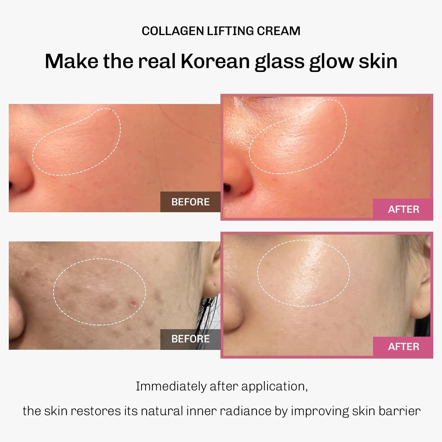 Collagen Lifting Cream