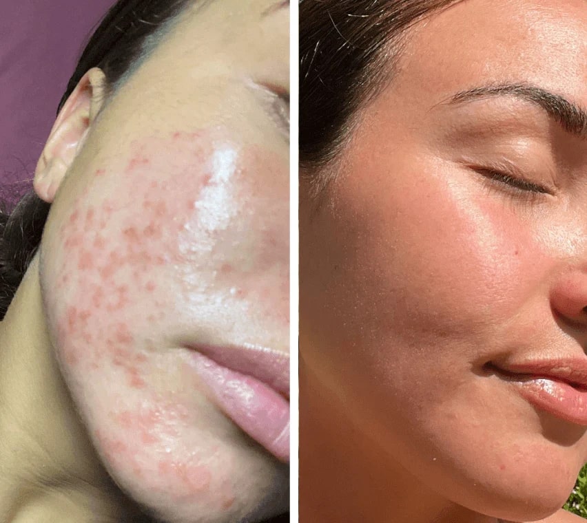 LumiDark LED Face Mask