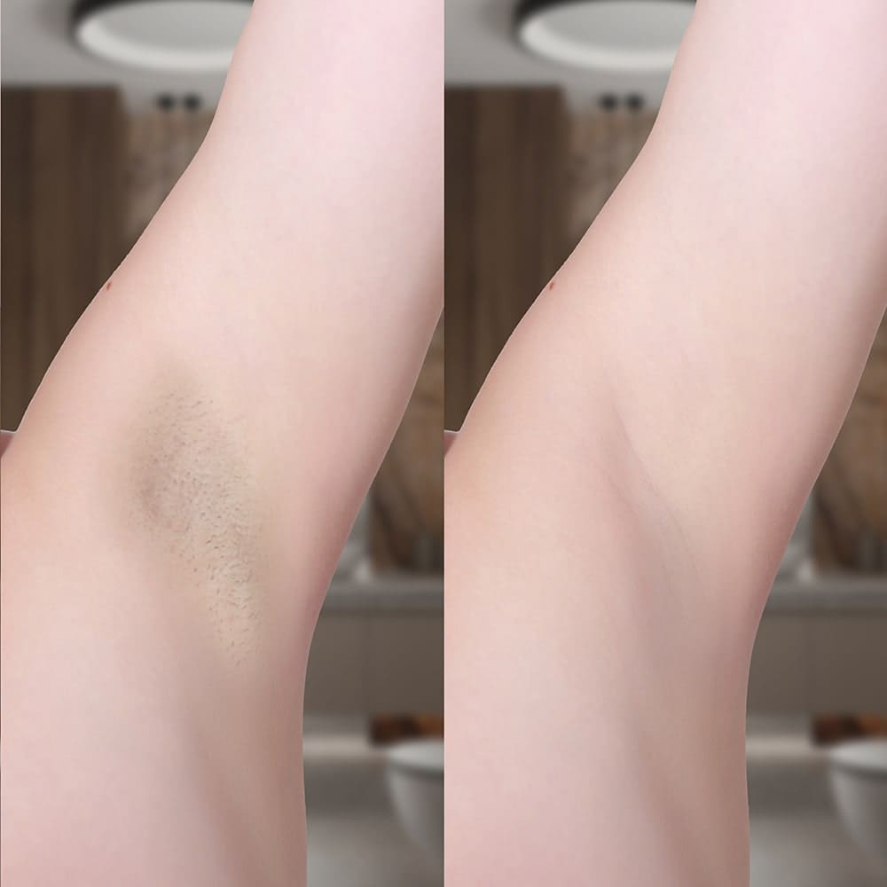 Lumi IPL Hair Remover