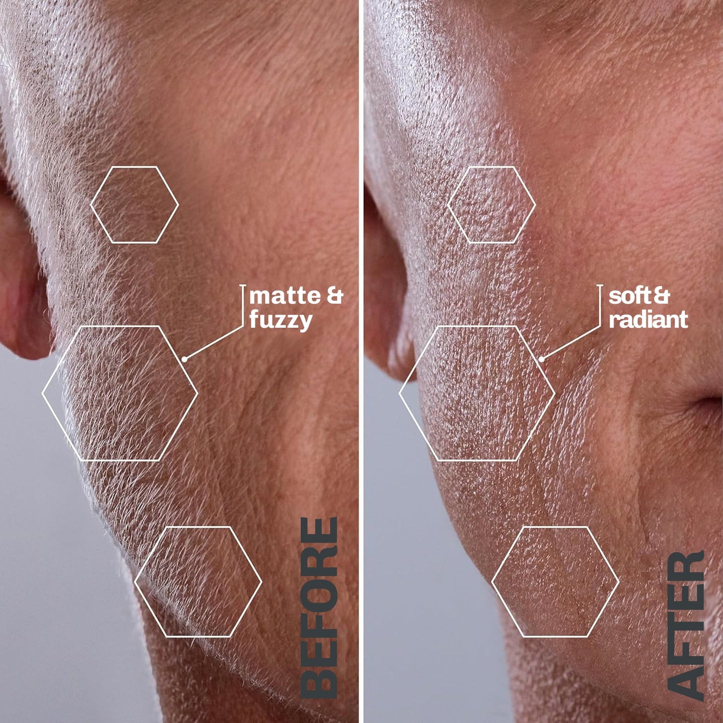 SilkyFlash+ Ultrasonic Hair Removal