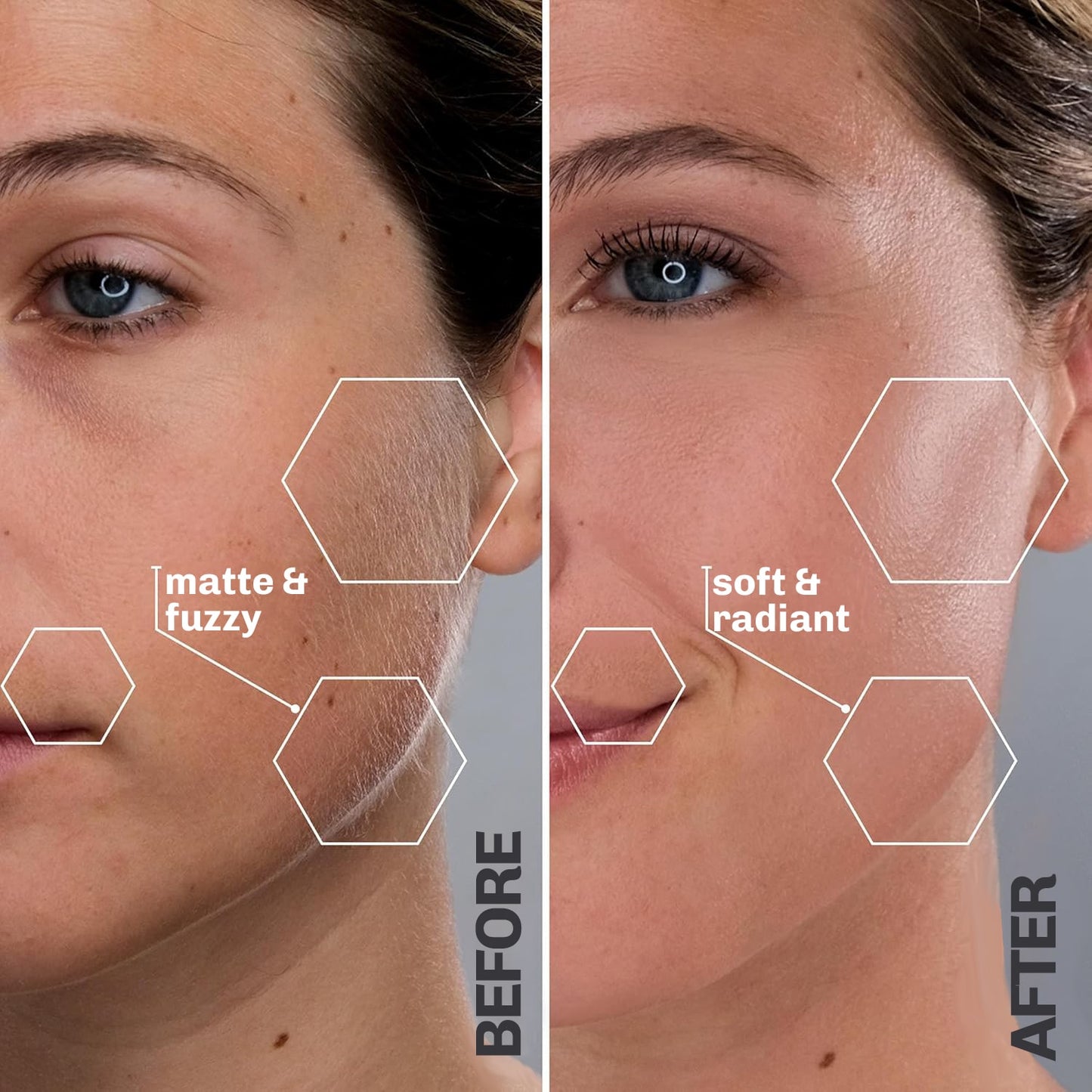 SilkyFlash+ Ultrasonic Hair Removal