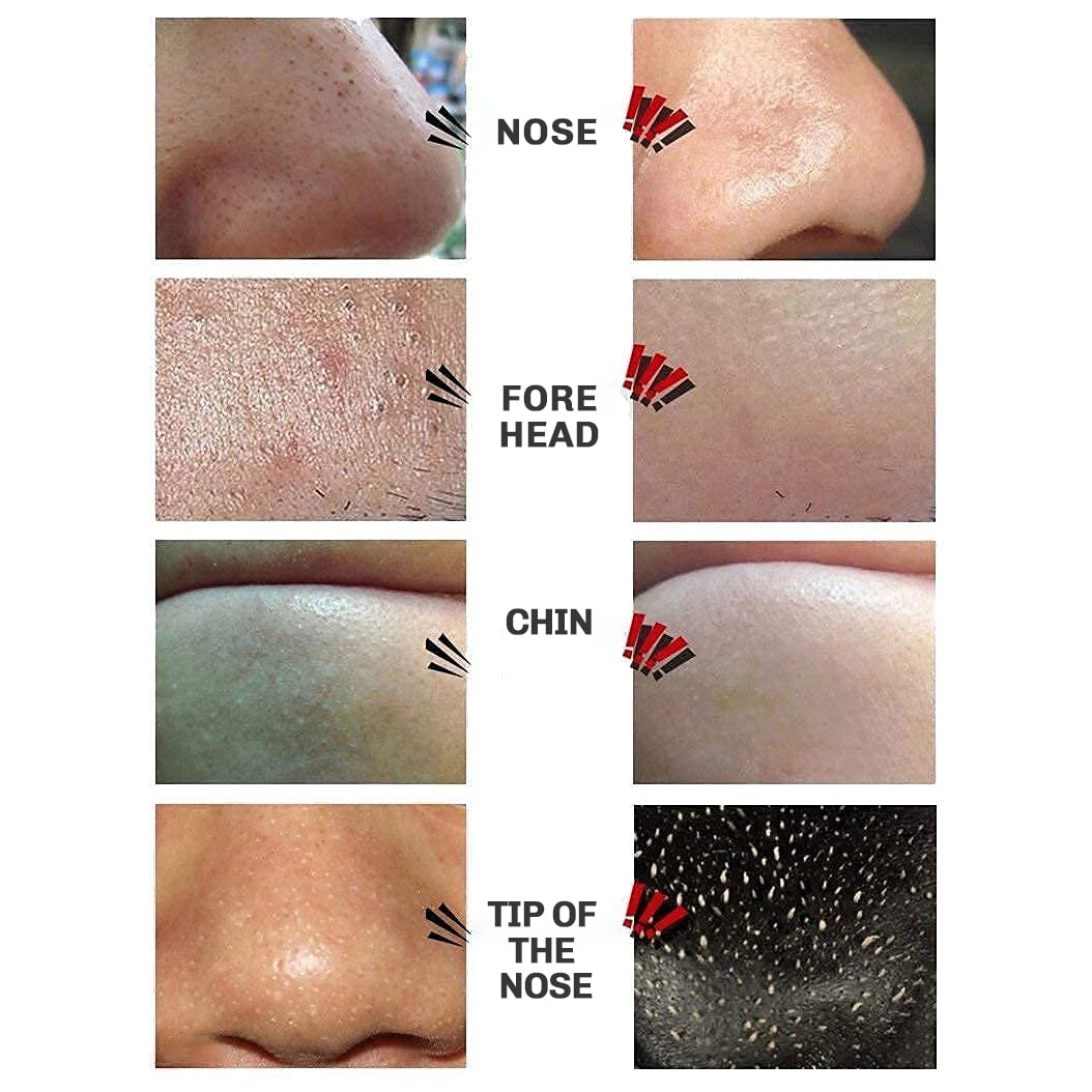 Blackhead Peel-Off Mask