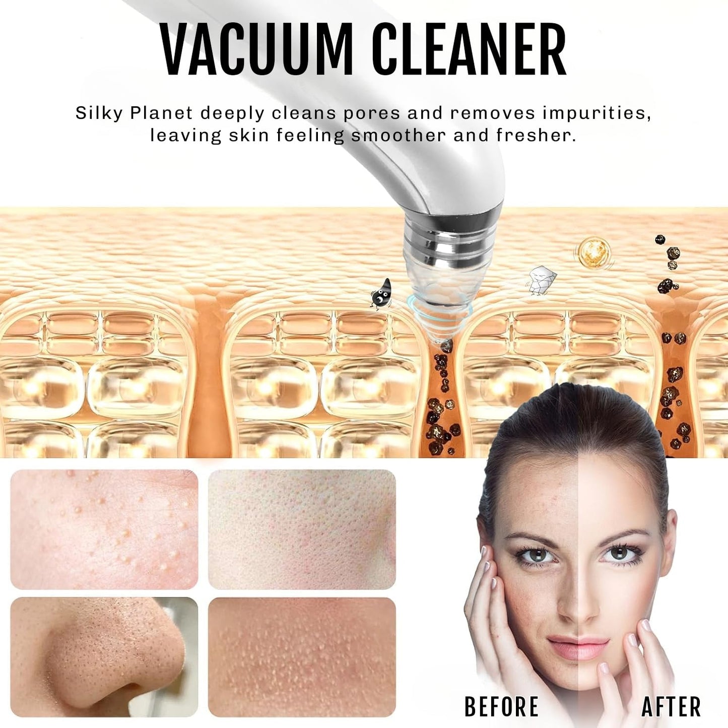 Blackhead Removal Kit