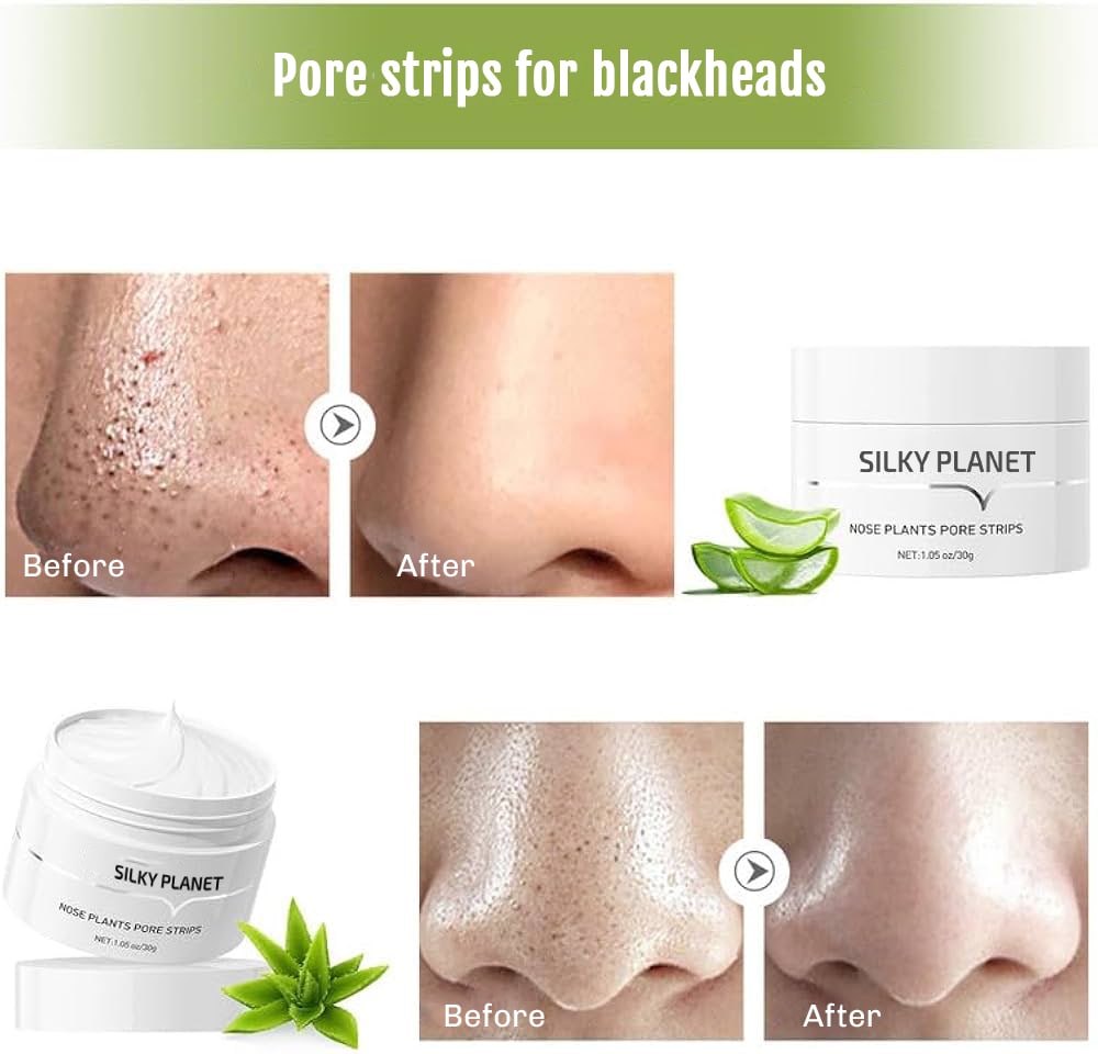 Blackhead Remover Cream