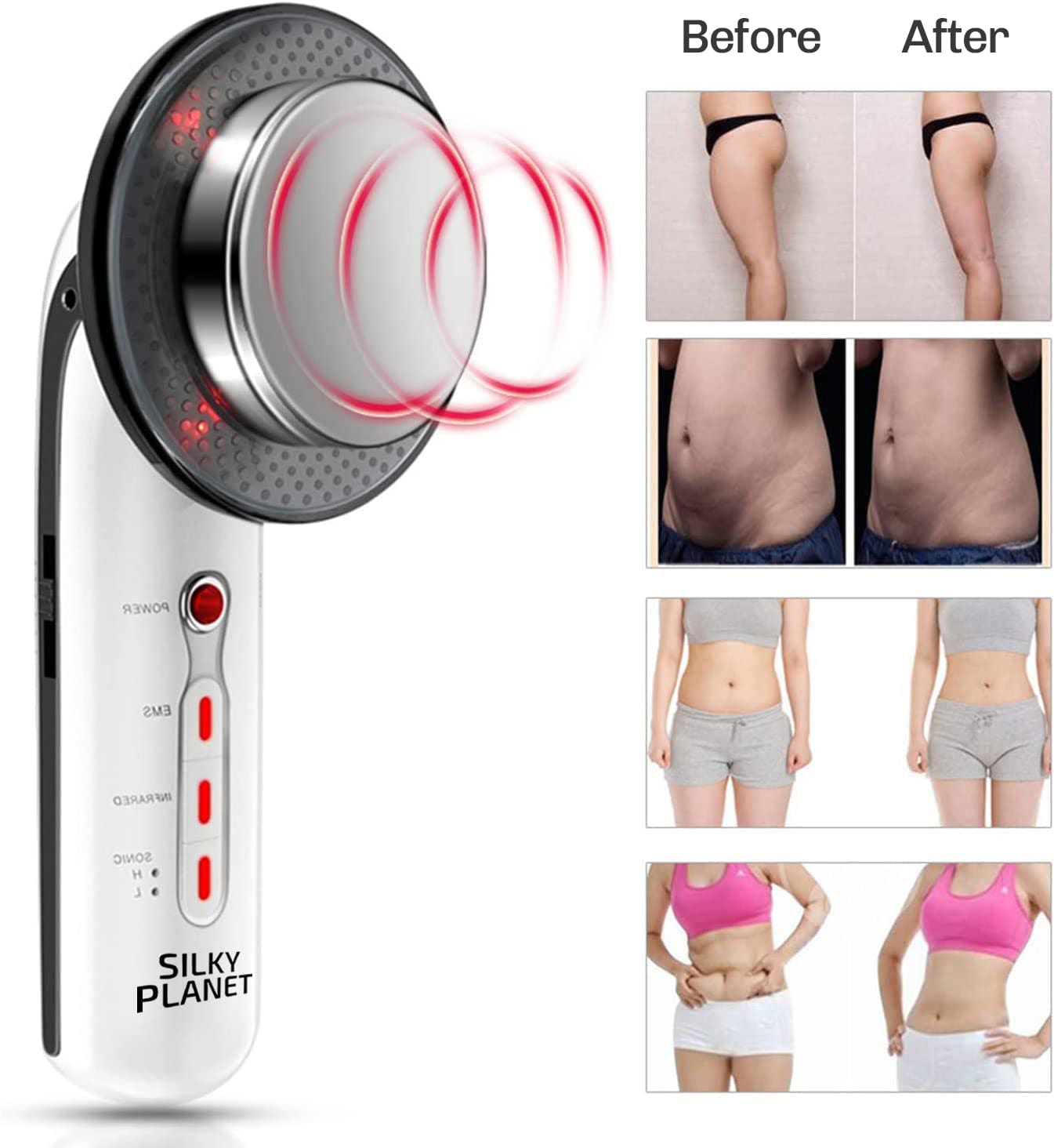 CelluX Anti-Cellulite Massager